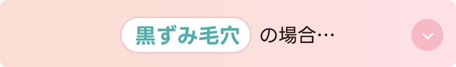 黒ずみ毛穴の場合…